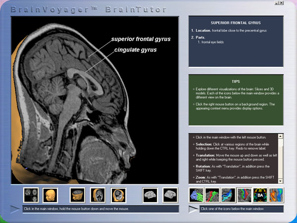 brain voyager